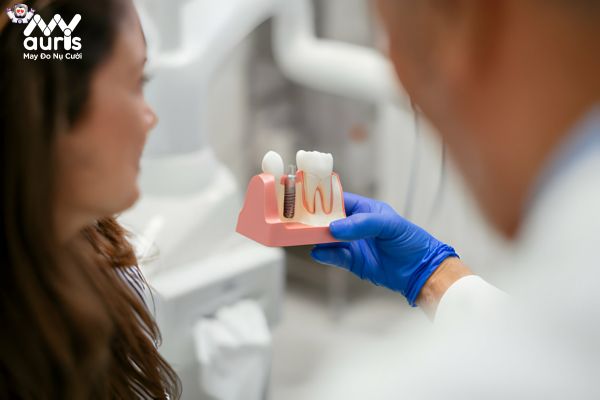 Một số yếu tố ảnh hưởng đến thời gian thực hiện trồng răng Implant 