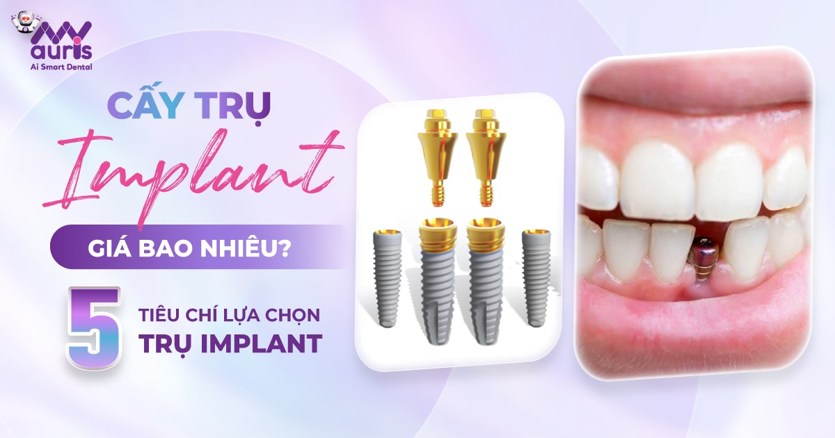 Cấy trụ implant giá bao nhiêu