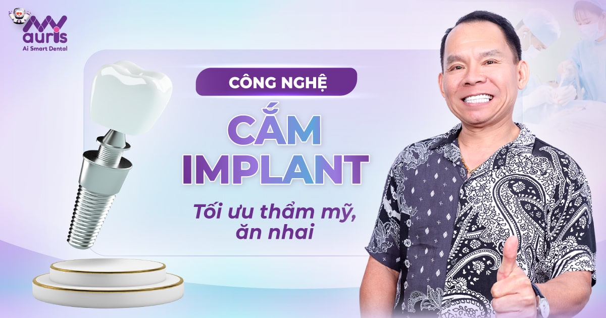 Công nghệ cắm implant