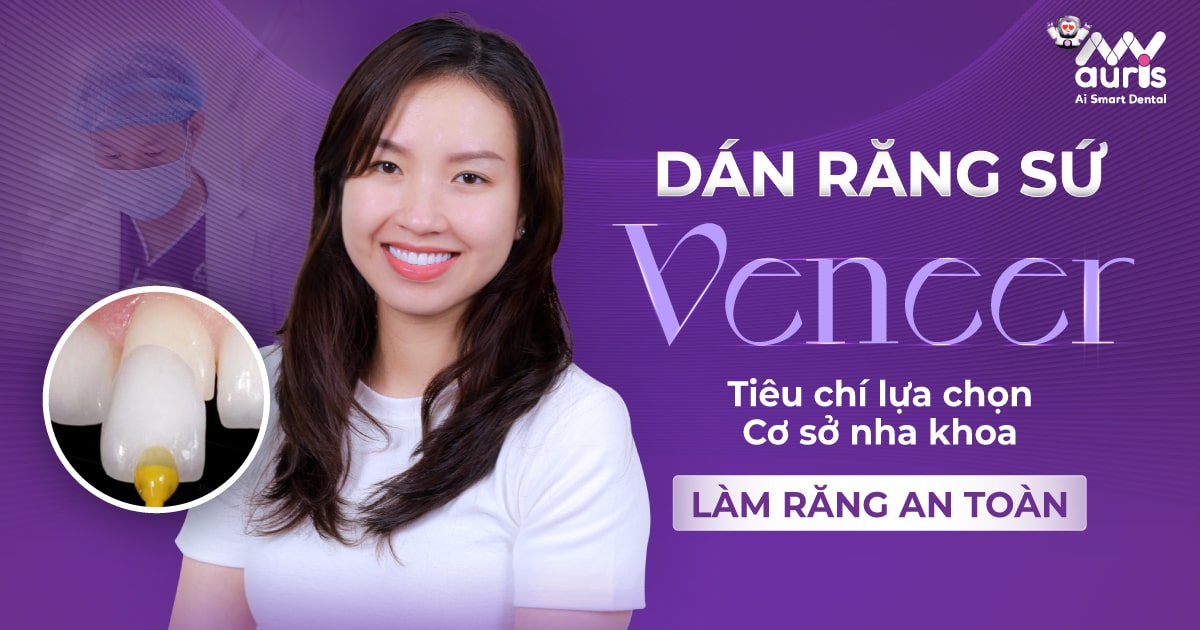 6 tiêu chí đánh giá dán răng sứ Veneer ở đâu tốt