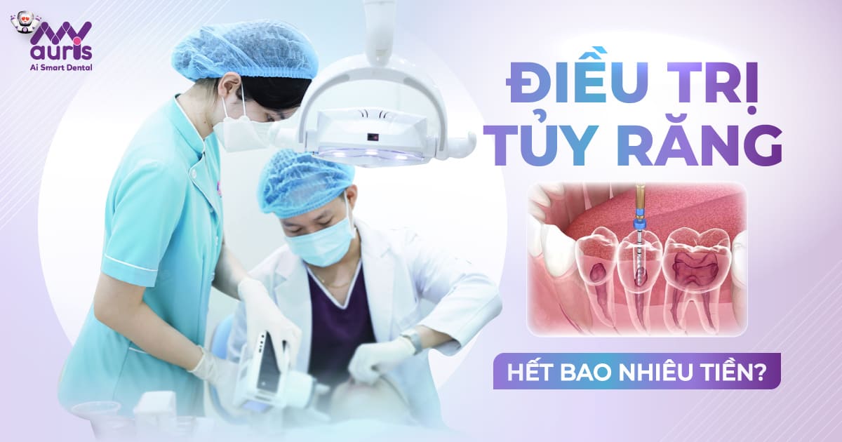 điều trị tủy răng hết bao nhiêu tiền