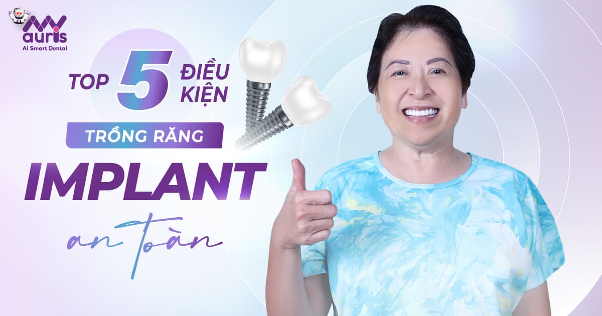 điều kiện để trồng răng implant