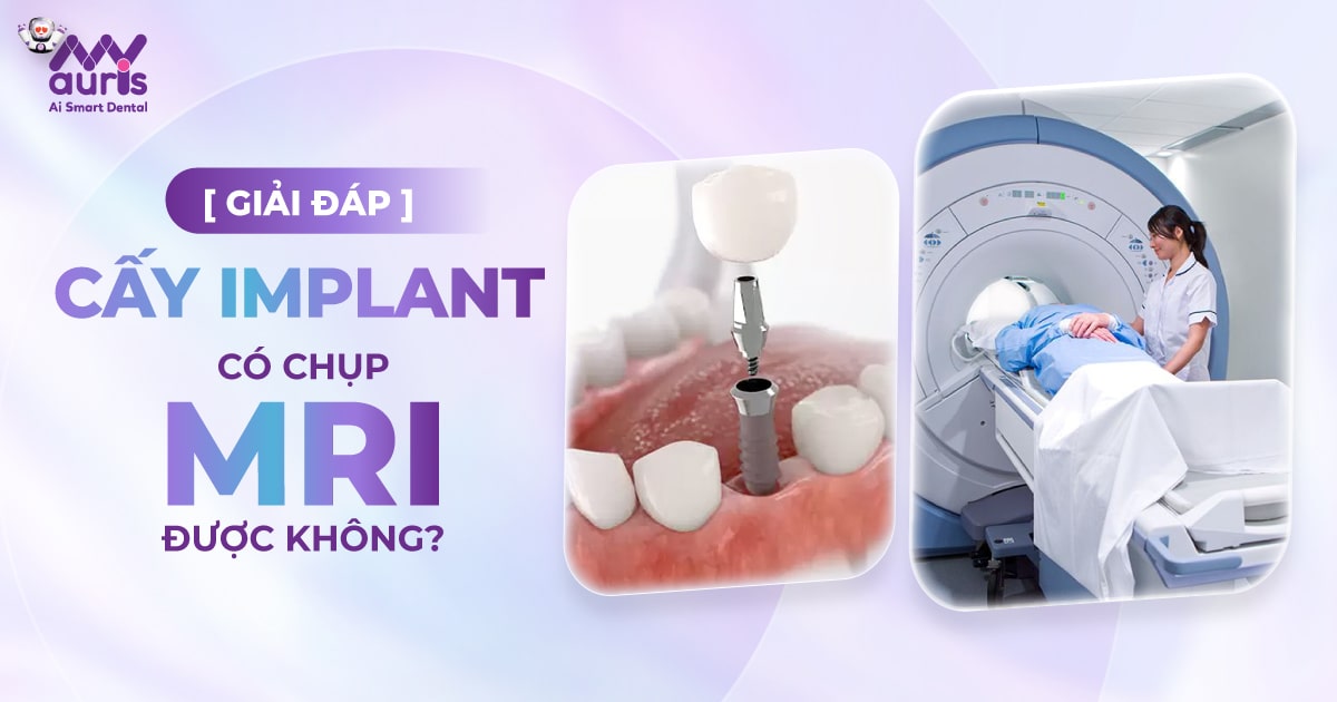 Cấy implant có chụp mri được không?