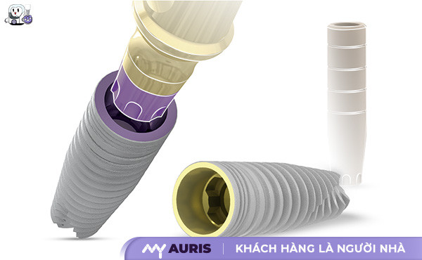 implant mis của nước nào,implant đức