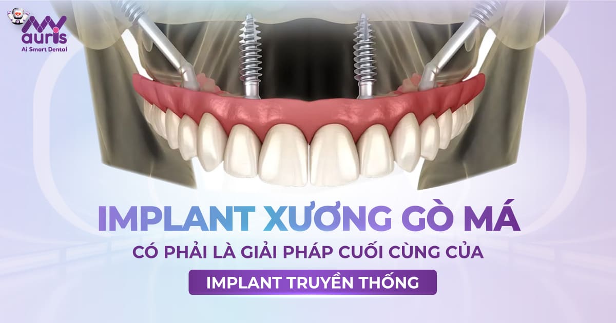 implant thuỵ sĩ