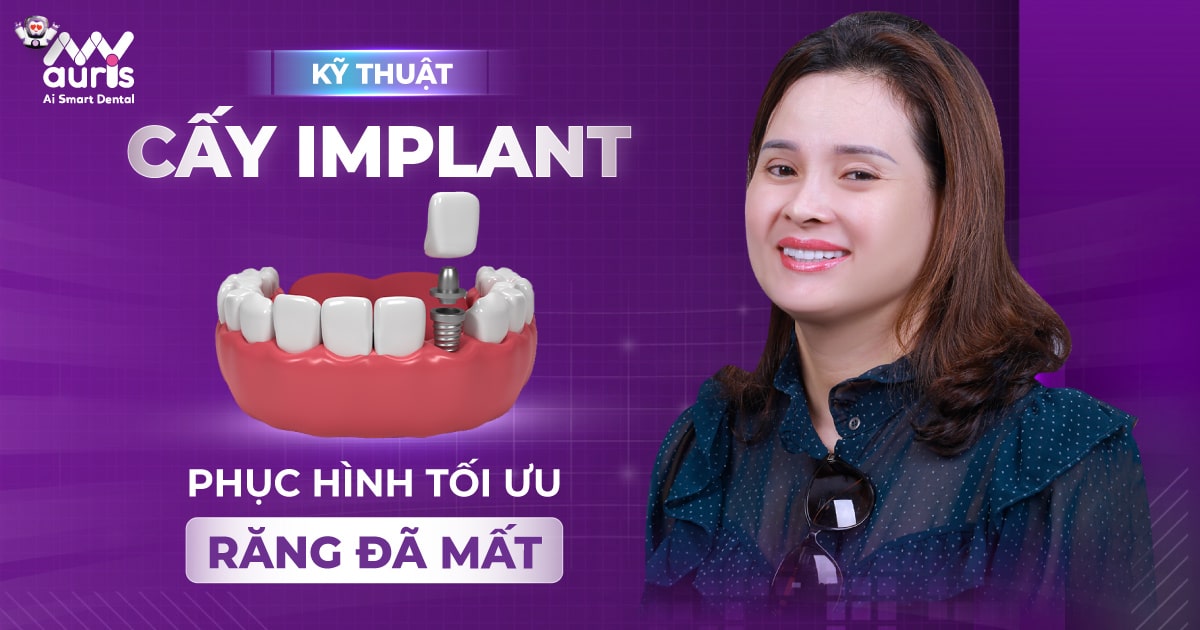 Kỹ thuật cấy implant