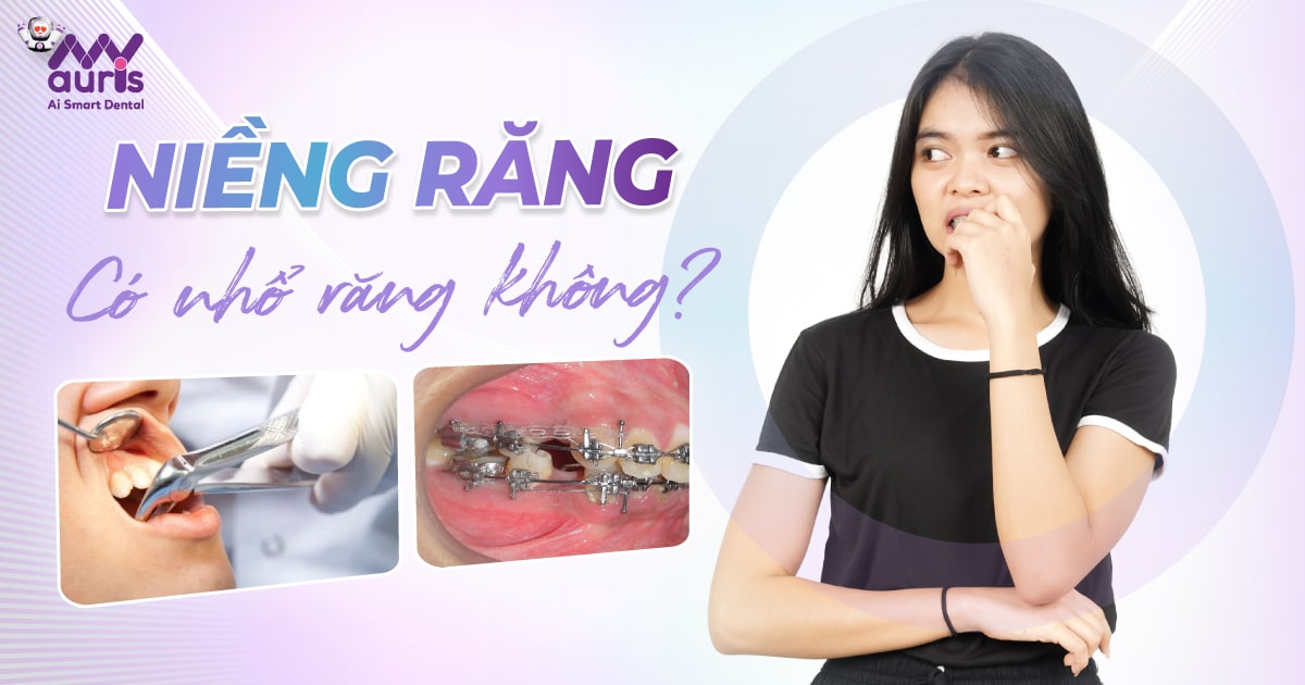 Niềng răng có nhổ răng? Áp dụng trường hợp nào?