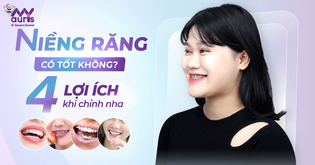 niềng răng có tốt không