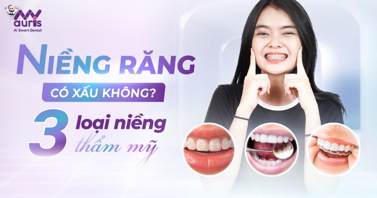 niềng răng có xấu không