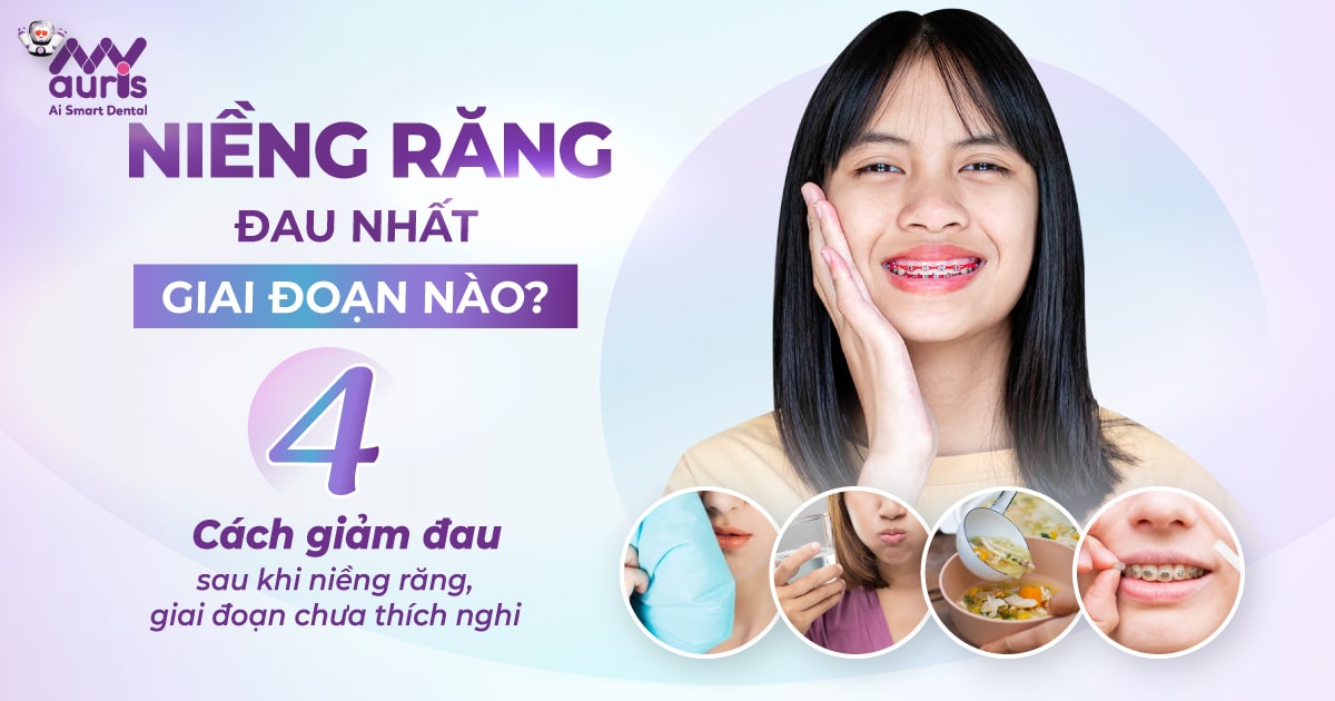 Niềng răng đau nhất giai đoạn nào