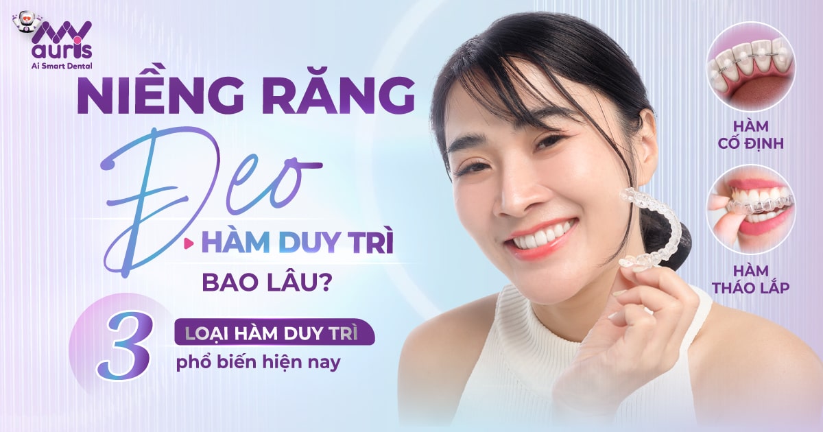 Niềng răng đeo hàm duy trì bao lâu