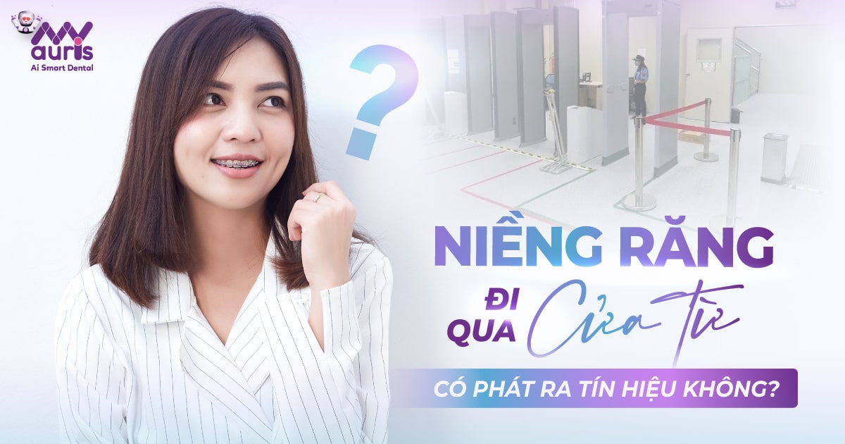 Niềng răng đi qua cửa từ có phát ra tín hiệu không?