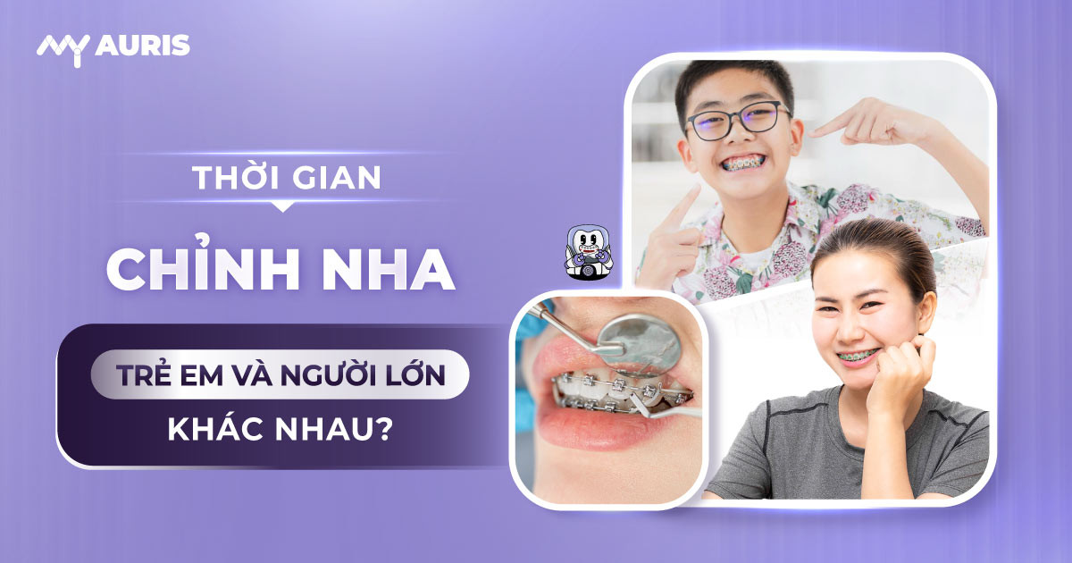 niềng răng mấy năm
