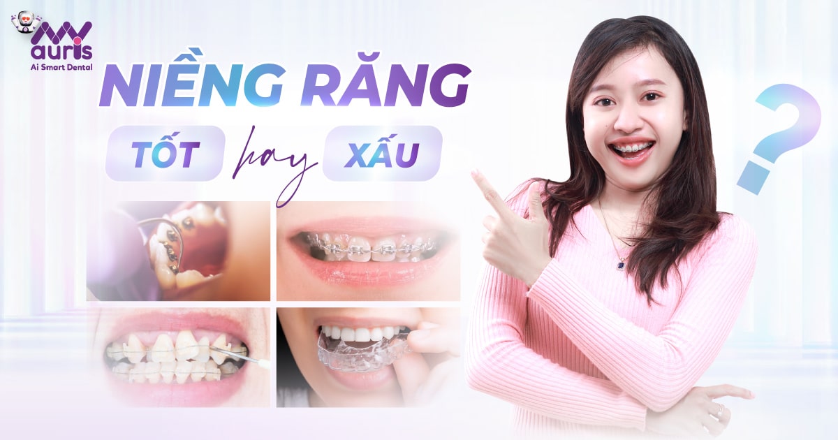 Niềng răng tốt hay xấu-Tại sao nên điều trị chỉnh nha?