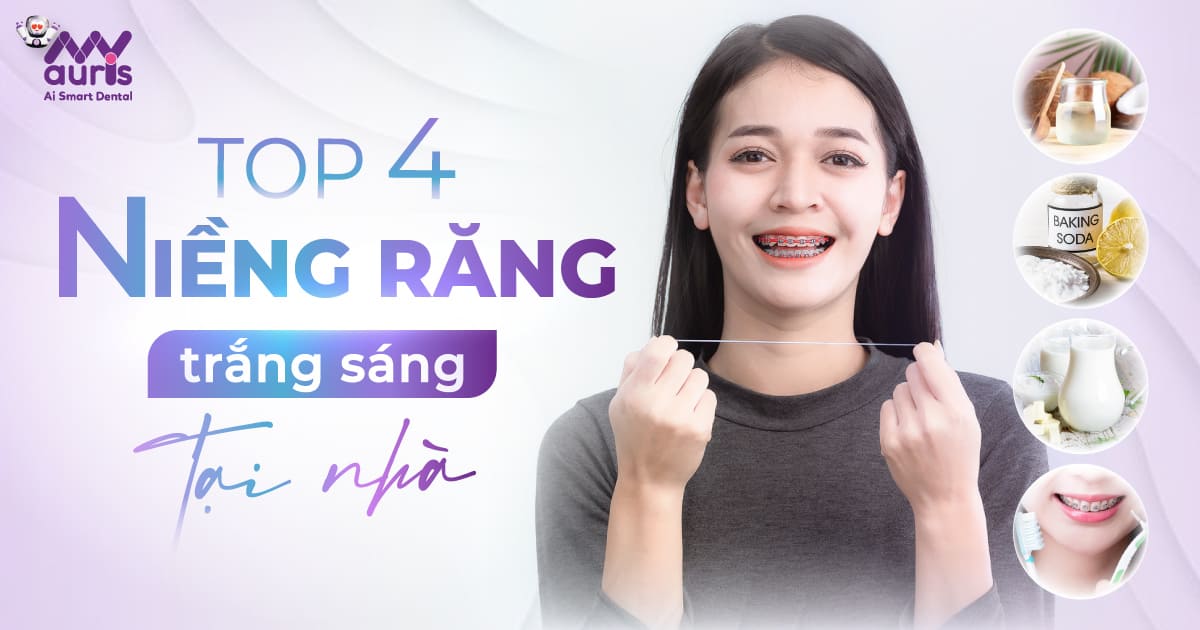 niềng răng trắng