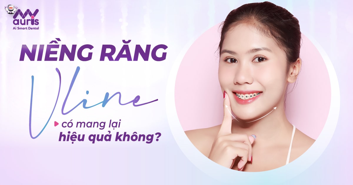 Niềng răng V line có mang lại hiệu quả không?