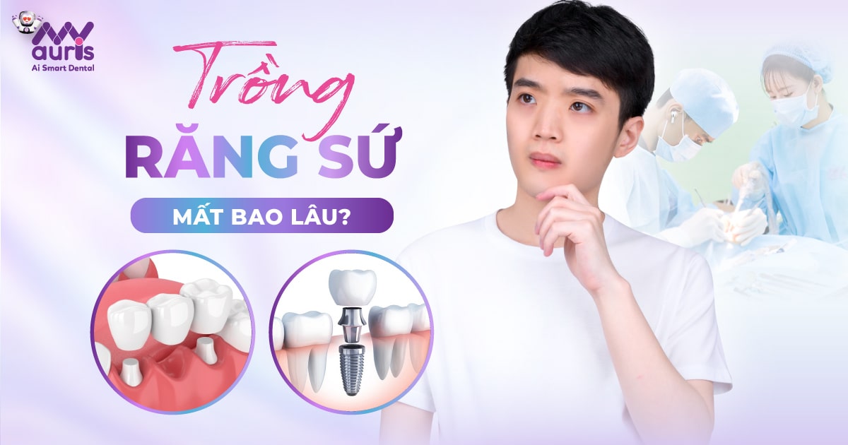 Trồng răng sứ mất bao lâu? - Ai nên thực hiện?