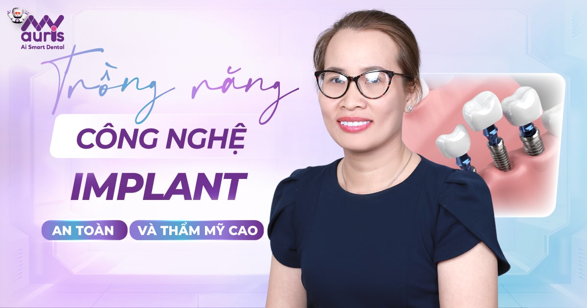 6 ưu điểm của trồng răng công nghệ Implant mang lại