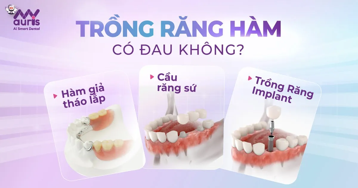 Trồng răng hàm có đau không? 3 phương pháp chính
