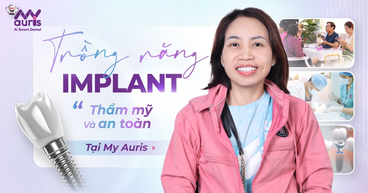 Trồng răng Implant ở Sài Gòn - 5 tiêu chí đánh giá