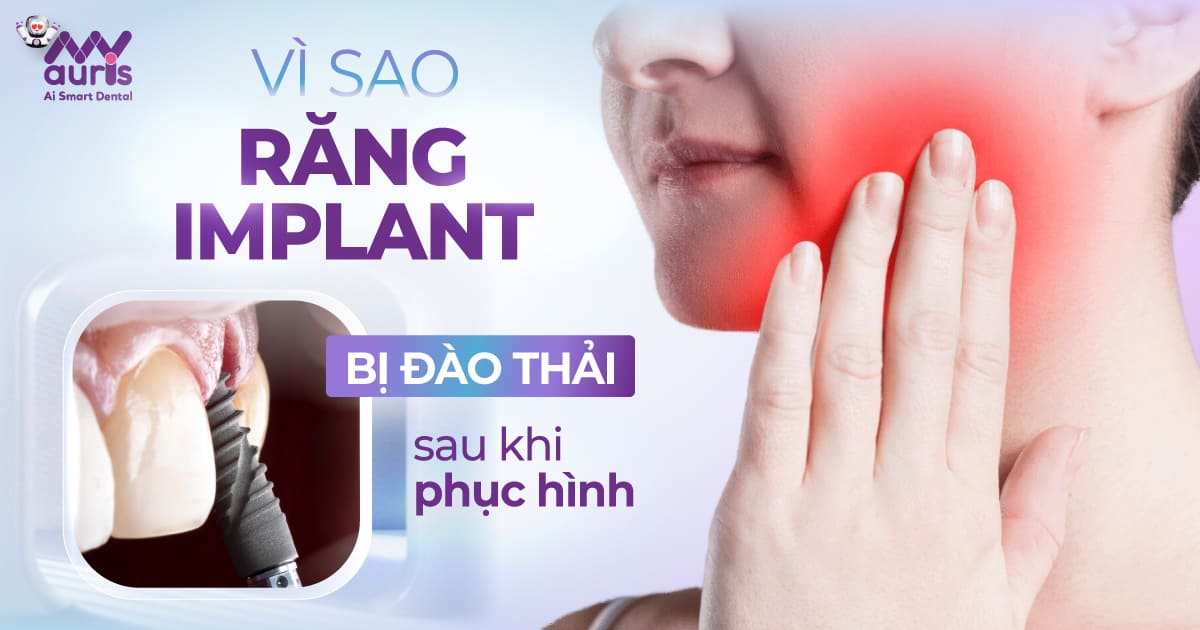 implant bị đào thải