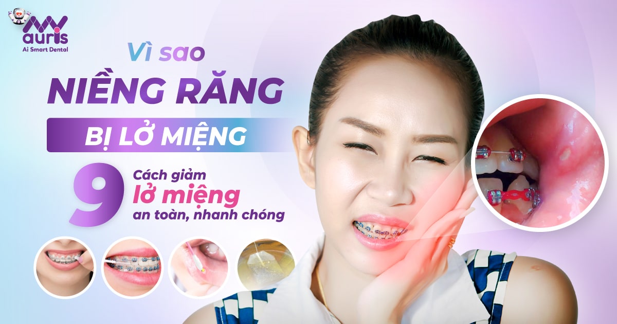 Vì sao niềng răng bị lở miệng