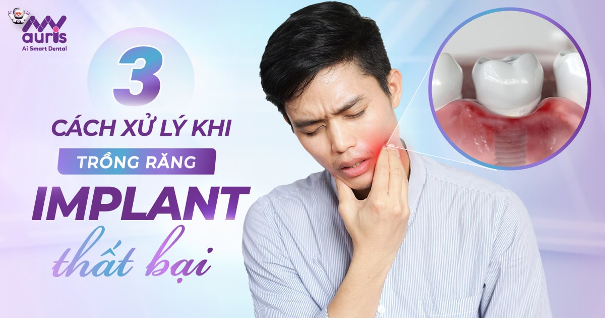 3 cách xử lý khi trồng răng implant thất bại