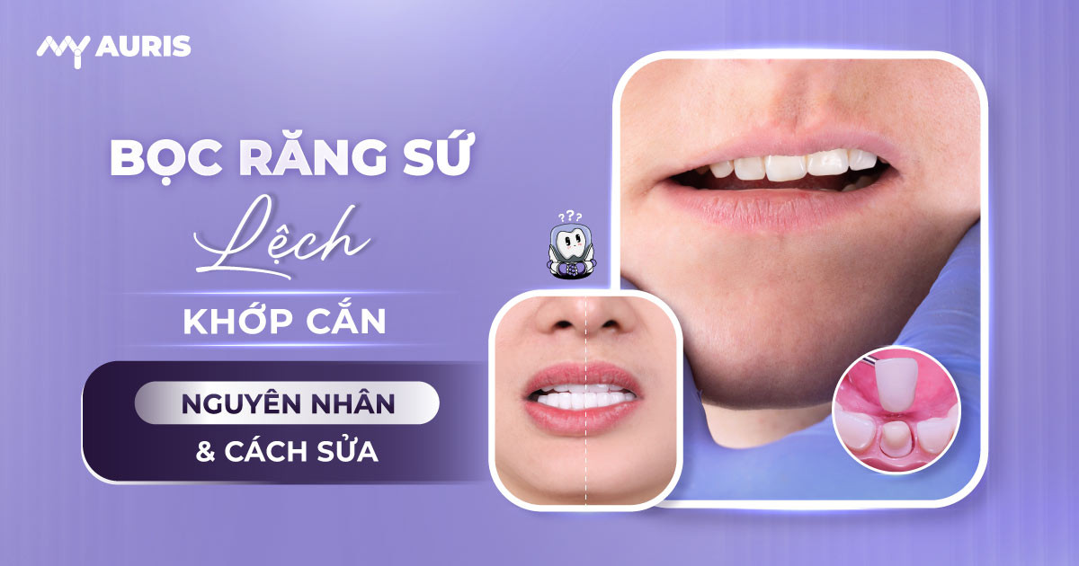 bọc răng sứ bị lệch khớp cắn