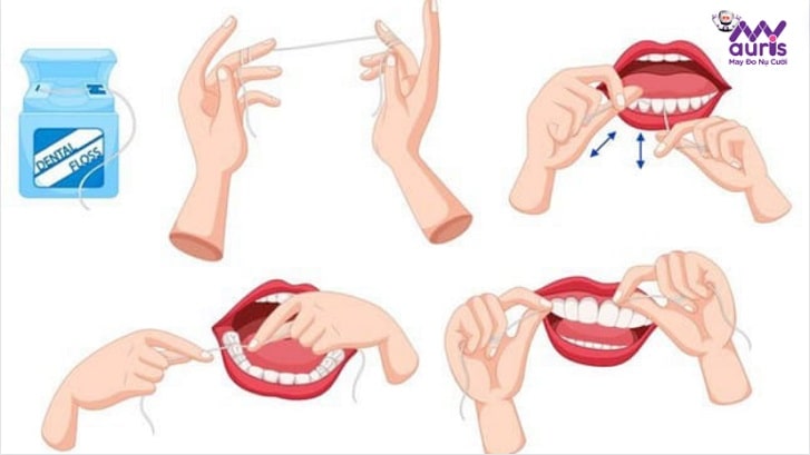 cách chăm sóc răng sứ sau khi bọc