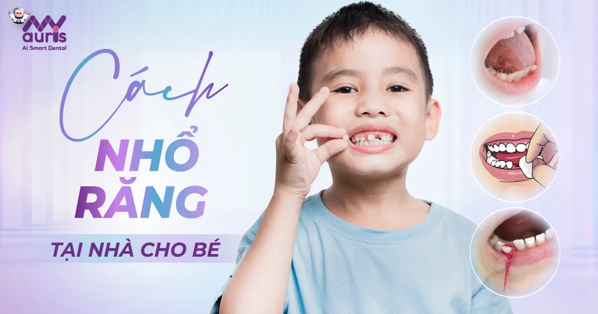 4 cách nhổ răng tại nhà cho trẻ được áp dụng phổ biến