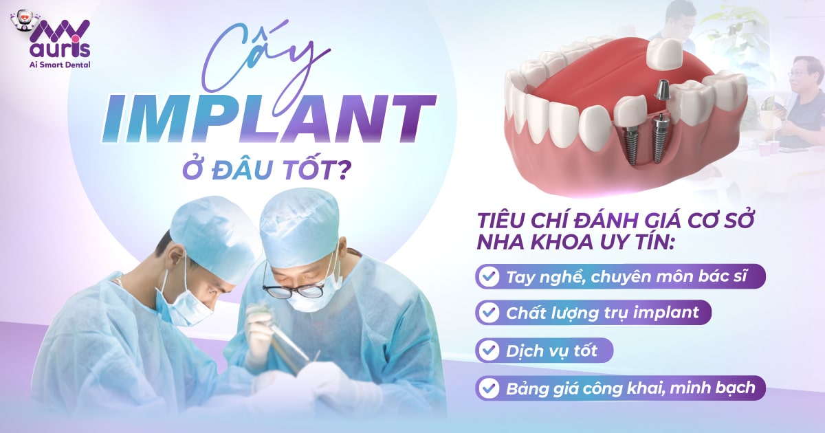 Cấy implant ở đâu tốt