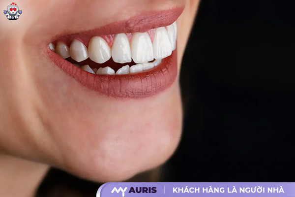 sau khi bọc răng sứ nên làm gì