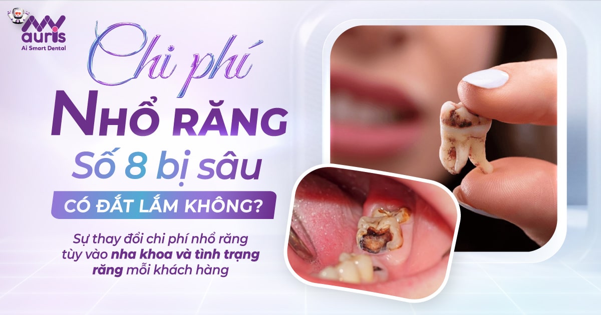 Chi phí nhổ răng số 8 bị sâu có đắt lắm không?