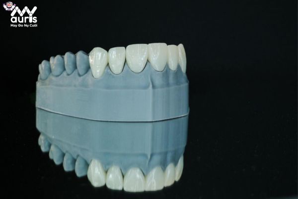 Chí phí làm răng sứ ở mỗi nha khoa sẽ dao động khác nhau