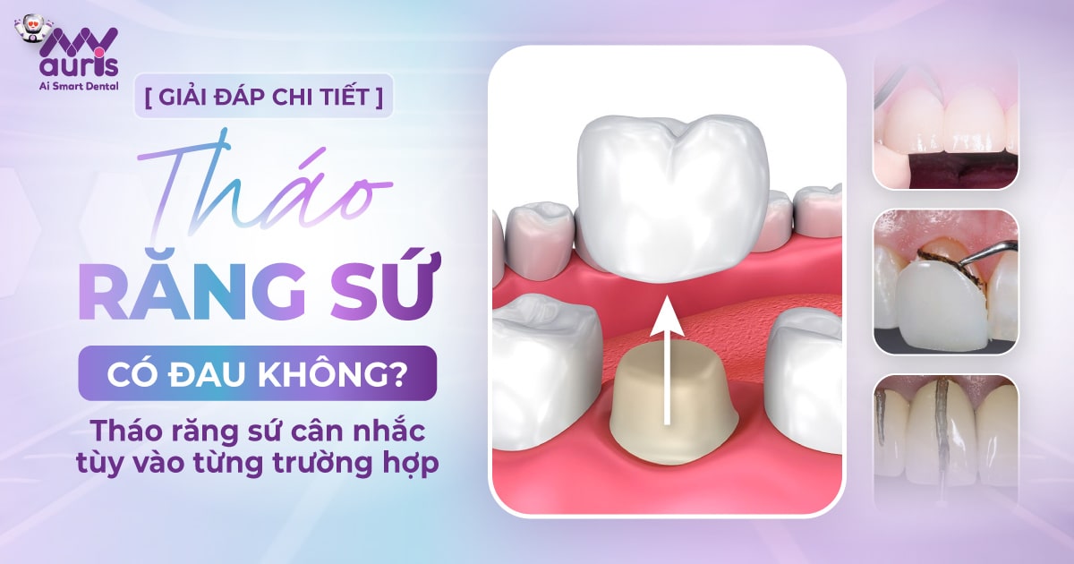 [GIẢI ĐÁP CHI TIẾT] Tháo răng sứ có đau không?