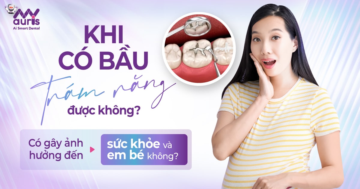 Khi có bầu trám răng được không