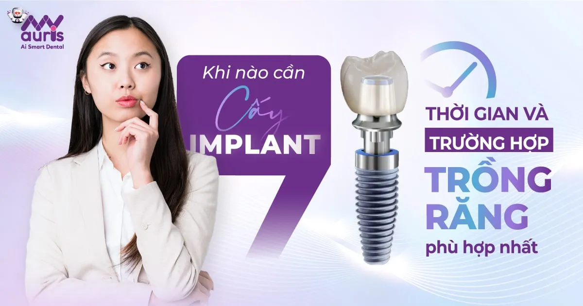 Khi nào cần cấy implant