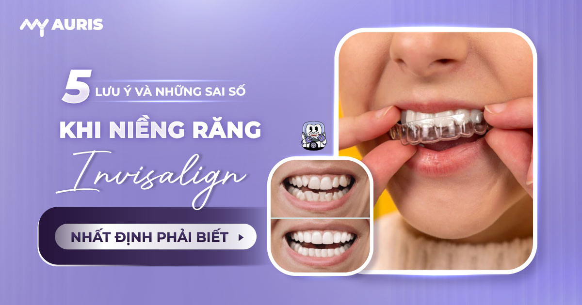 kinh nghiệm niềng rang,kinh nghiệm niềng răng invisalign
