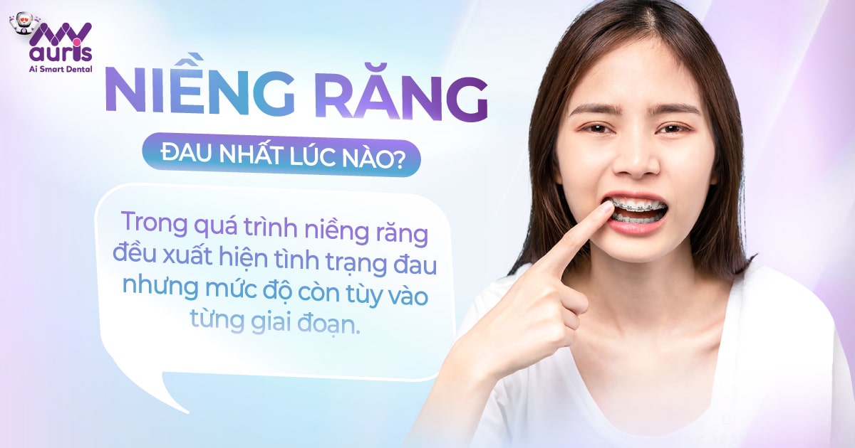 Niềng răng đau nhất lúc nào