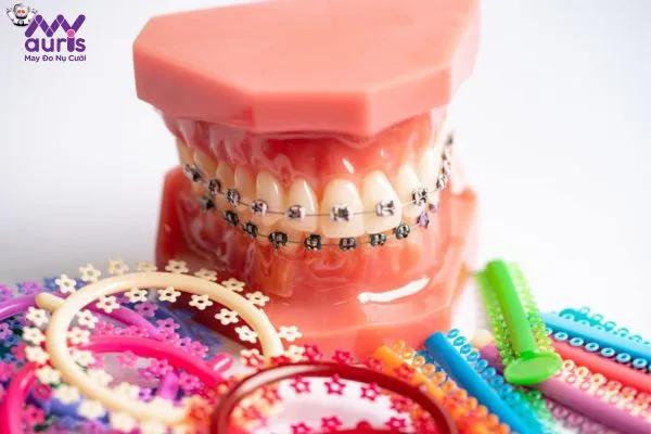Hỏi đáp nha khoa - Niềng răng giữ lại răng khểnh được không?