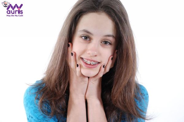 Niềng răng bị hóp má có diễn ra mãi mãi không?