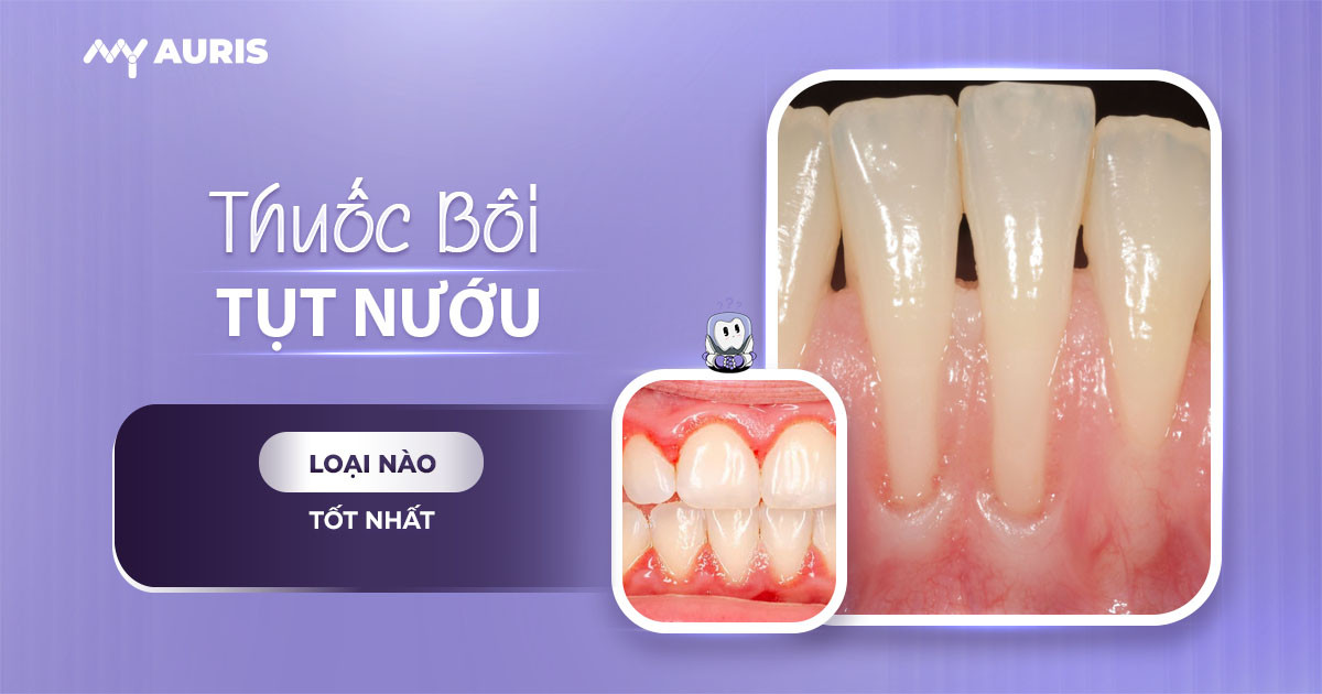 thuốc bôi chữa tụt lợi,tụt lợi,tụt lợi là gì,bị tụt lợi,răng bị tụt lợi,tụt lợi chân răng