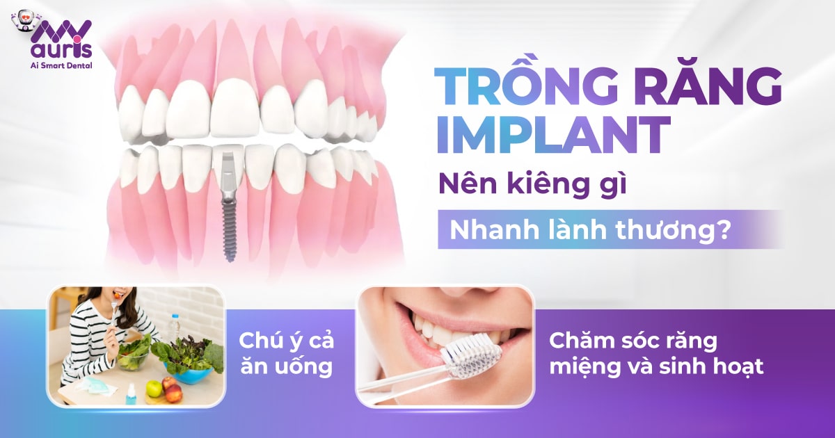 Trồng răng implant nên kiêng gì nhanh lành thương?