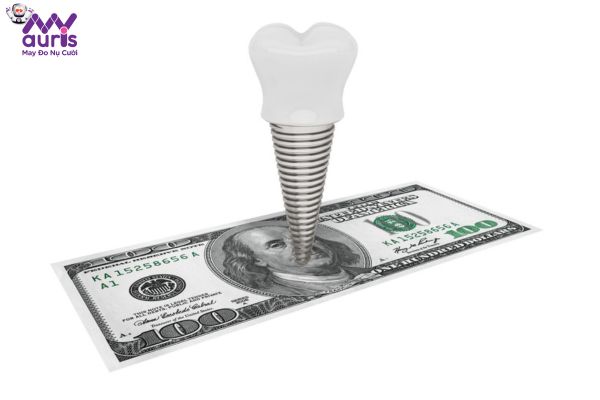 Tại sao nên chọn hình thức trồng răng Implant trả góp?