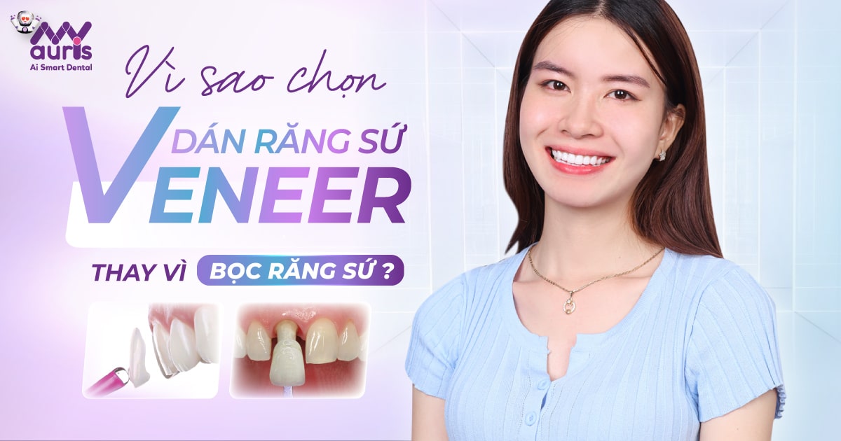 Vì sao chọn dán răng sứ veneer thay vì bọc răng sứ?