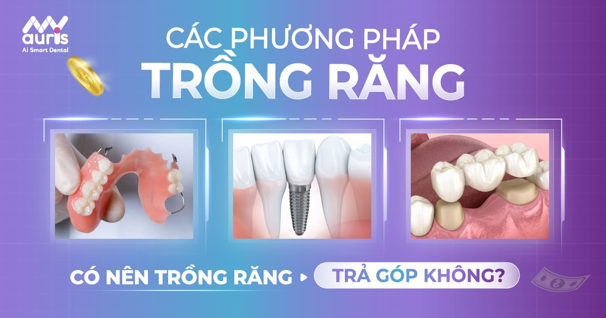 Các phương pháp trồng răng