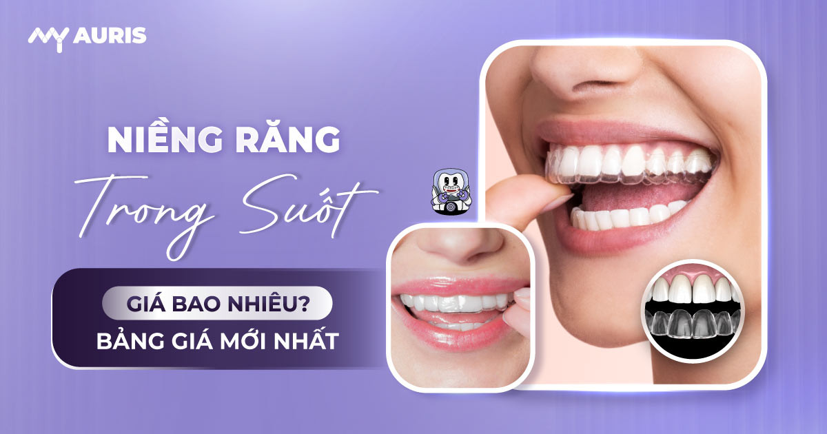 bảng giá niềng răng invisalign,giá niềng răng invisalign,giá niềng răng trong suốt