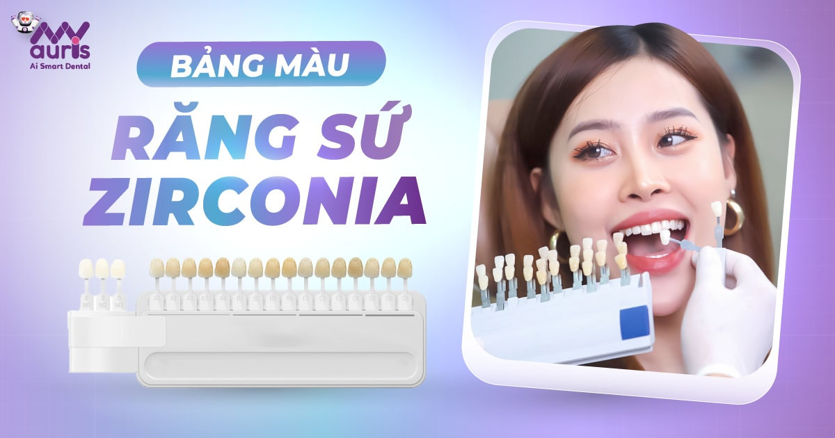 Bảng màu răng sứ Zirconia - 5 tiêu chí lựa chọn màu sắc