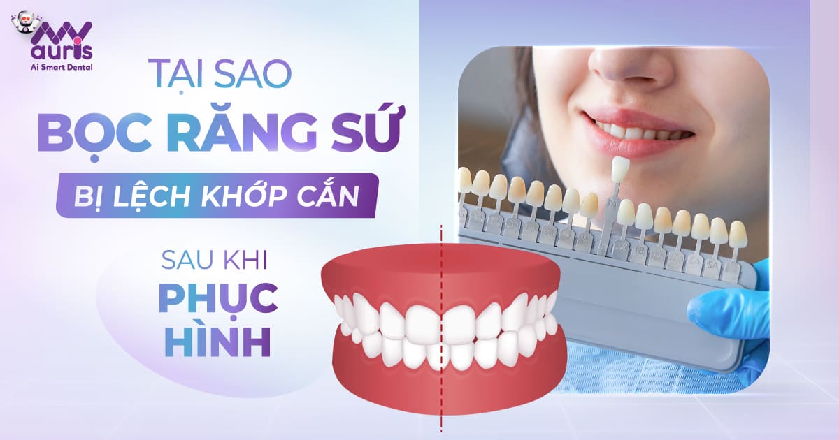 bọc răng sứ bị lệch khớp cắn