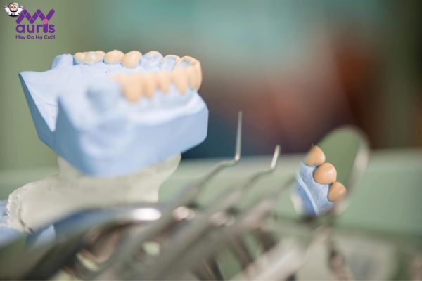 Những yếu tố nào gây ảnh hưởng đến chi phí bọc răng sứ?